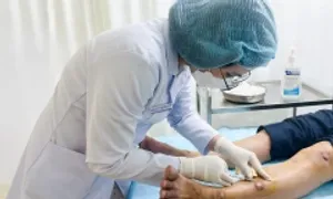 Sẩn cục khắp tay chân do viêm da mạn tính